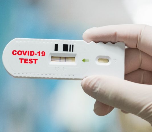 Hot Spot pediatrici per tamponi immediati